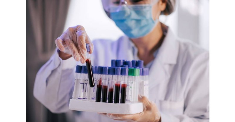 Exame de sangue detecta Alzheimer em descoberta de cientistas brasileiros