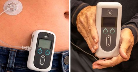 Anvisa libera novo produto para quem não responde aos tratamentos convencionais de Parkinson